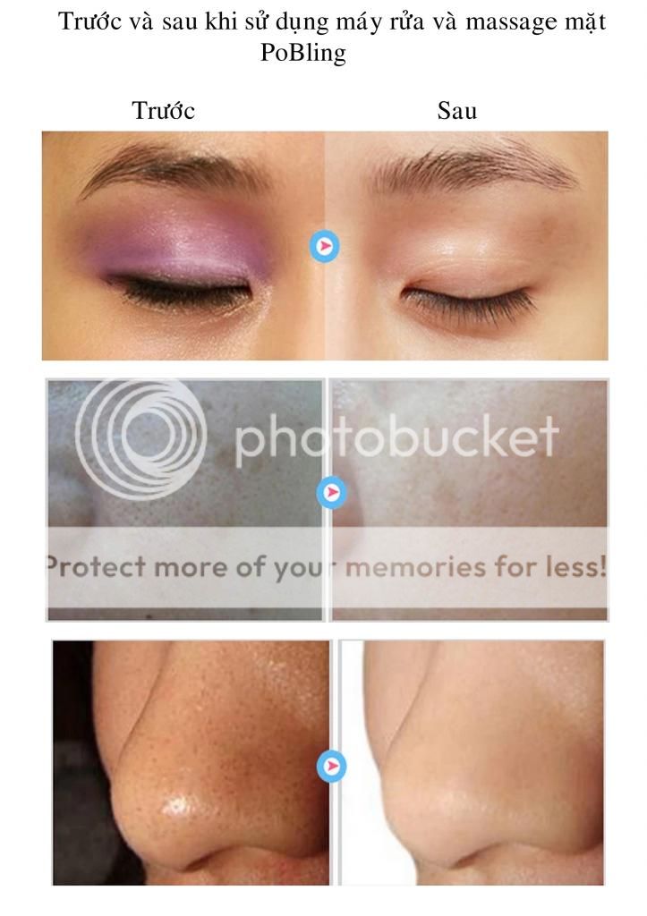 Máy rửa và massage mặt PoBling - 9